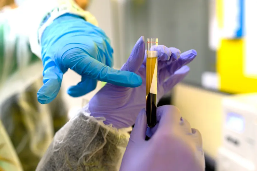 Після свят: які аналізи допоможуть перевірити стан організму?