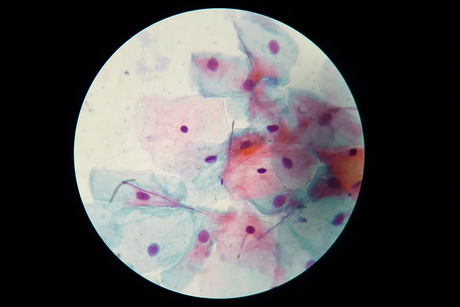 У тіні великого відкриття: жінка, без якої не було б ПАП-тесту 