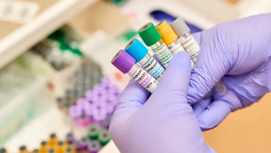 ПЛР. Toxoplasma gondii