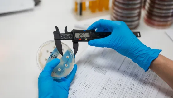 Коли антибіотики перестають працювати: роль лабораторної діагностики у стримуванні резистентності