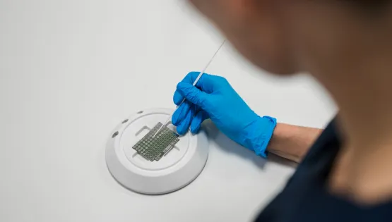 Діагностика оніхомікозів і мікозів стоп у CSD LAB: точність, на яку можуть спиратися подологи