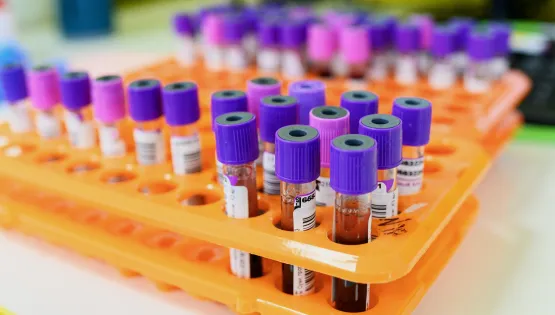 загальний аналіз крові