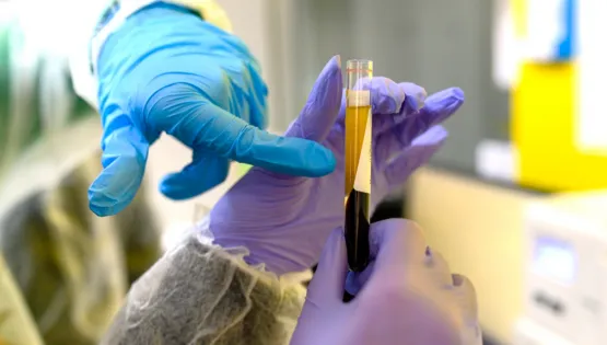 Ліпідограма