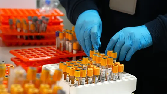 Комплекс №5 "Ліпідограма" (холестерин, тригліцериди; ЛПВЩ, ЛПНЩ, ЛПДНЩ, індекс атерогенності) \ N