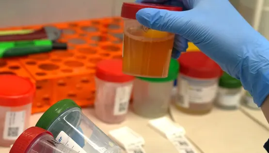 Бакпосів сечі на мікрофлору. Автоматична ідентифікація бактерій та грибів до виду методом MALDI-TOF MS. Антибіотикограма ДДМ. Антимікотикограма