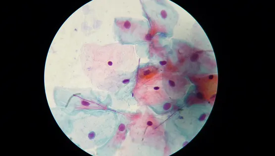 Рідинна цитологія ПАП-тест