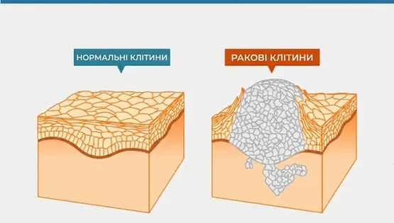 MyGene BRCA1/2 (NGS, скриніг спадкових мутацій, кров, Illumina) \ N