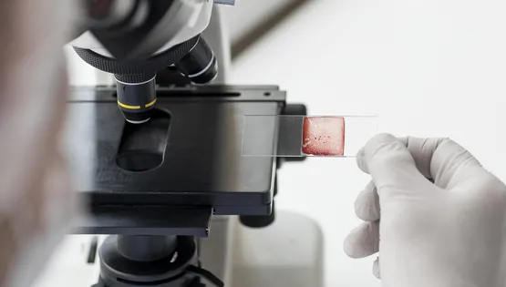 Комплекс №56 Рідинна цитологія ПАП-тест; ПЛР. Вірус папіломи людини (14 типів ВКР) (Cobas HPV тест затверджений FDA), якісне визначення з генотипуванням 16, 18 та групи з 31, 33, 35, 39, 45, 51, 52, 56, 58, 59, 66, 68 типів (у/г зішкріб) \ N