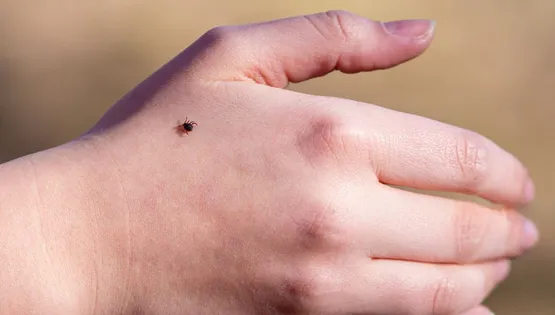 Кліщовий енцефаліт