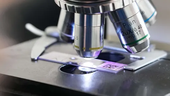 Рідинна цитологія ПАП-тест 