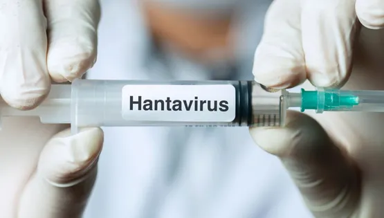 Hantavirus