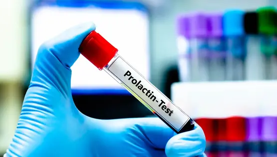 prolactin