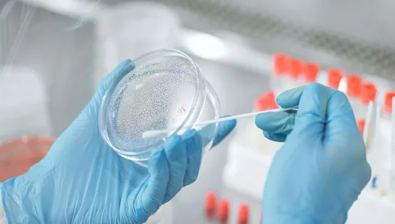 microbiological analyses