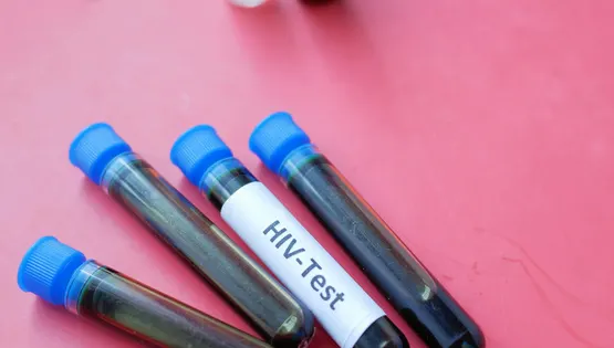 HIV
