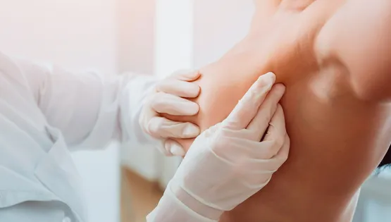 breast cancer