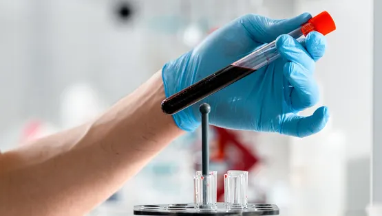 blood testing