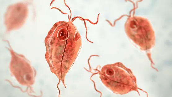 Trichomoniasis