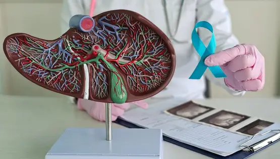 Gastric cancer