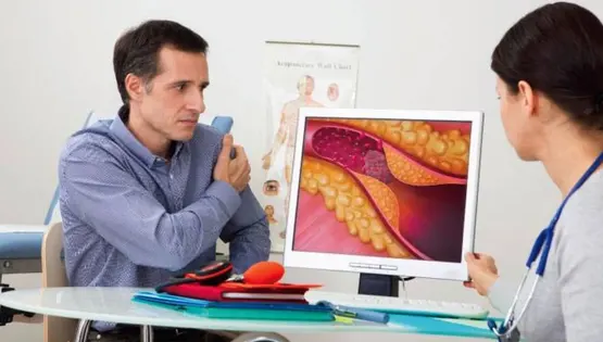 Atherosclerosis