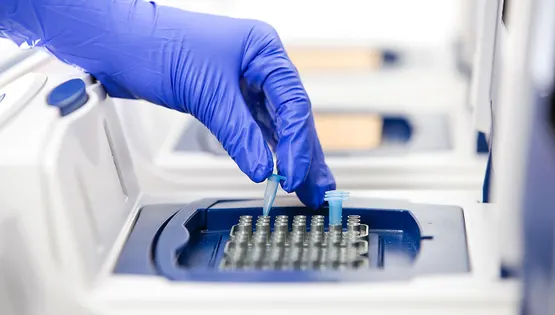 pcr