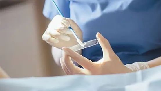 urogenital-smears
