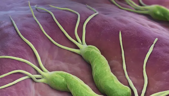 Helicobacter pylori