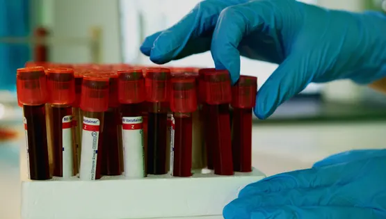 Онкомаркери для профілактики