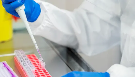 Молекулярна діагностика муковісцидозу та роль гена CFTR